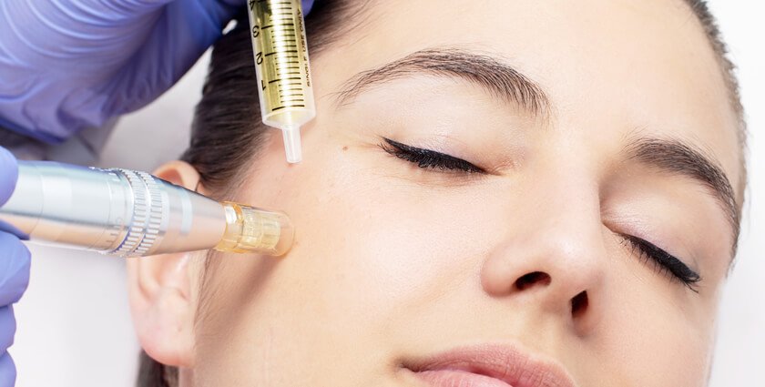 Revive-Face-Mesotherapy